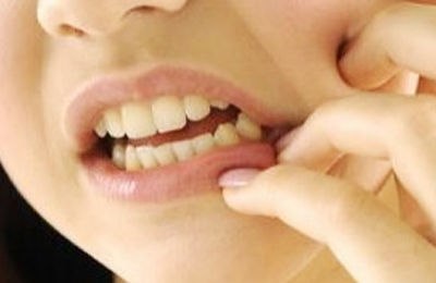 突發(fā)性、自發(fā)性的劇烈牙疼