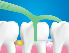 口腔問題可能要“命”！5大預警信號，別忽視