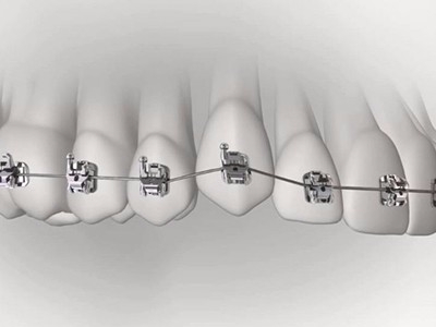 承德市哪家口腔醫(yī)院口腔正畸做得好？惟德口腔醫(yī)院來(lái)告訴您