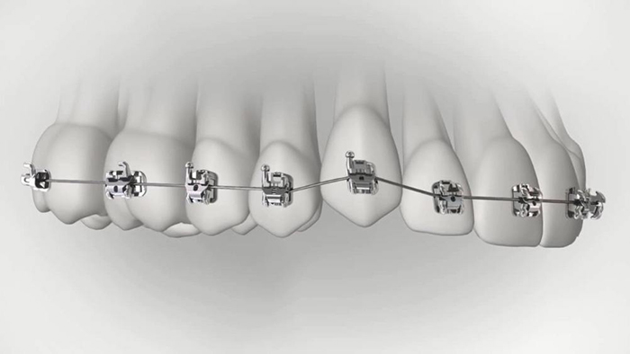 承德市哪家口腔醫(yī)院口腔正畸做得好？惟德口腔醫(yī)院來告訴您