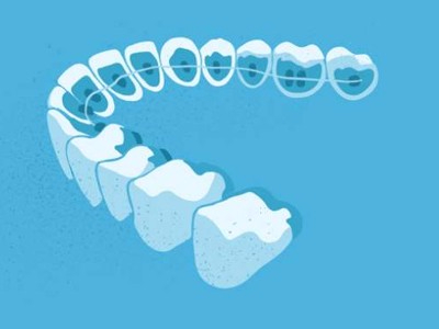 惟德口腔醫(yī)院口腔正畸好不好？