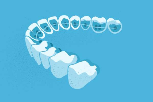 惟德口腔醫(yī)院口腔正畸好不好？